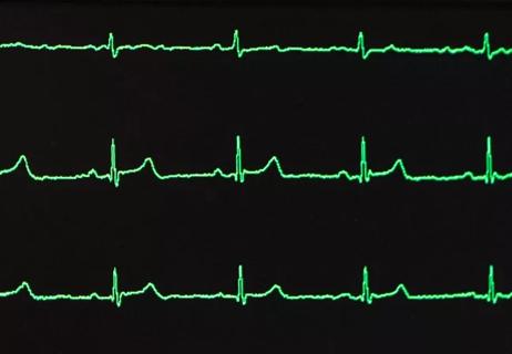 EKG_650-x450