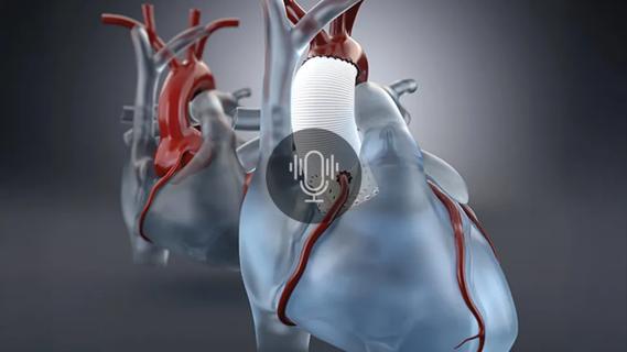two stylized models of the heart and aorta with a podcast button overlay