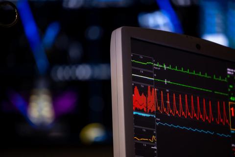 ECG