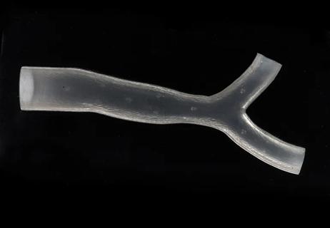 650&#215;450-lung-stent