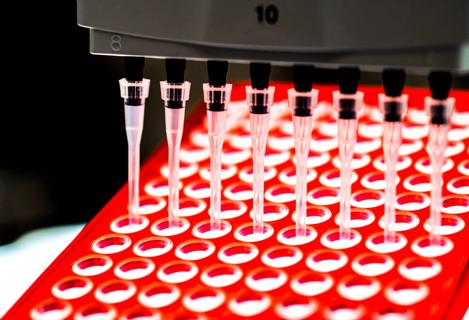 Lab test
