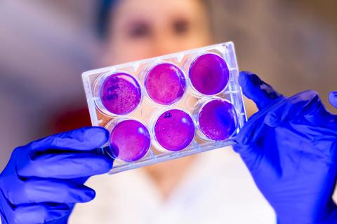Lab research