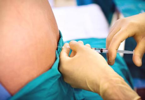 Person recieving an epidural injection in thier spine.