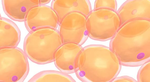 Making a Definitive Diagnosis of Lipedema