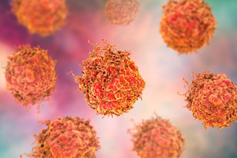 Prostate cancer cells