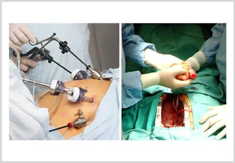 22-DDI-2682059 Rosenthal &#8211; Bariatric surgery as a bridge to transplant