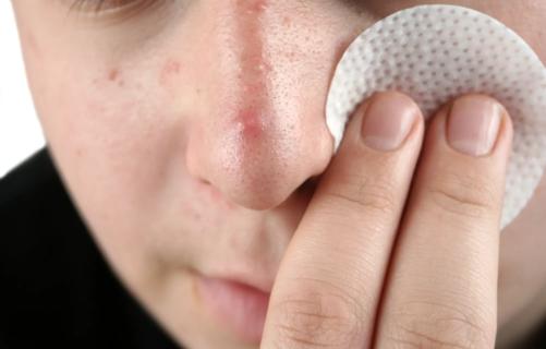 Person using two fingers to hold a makeup pad to their cheek up close
