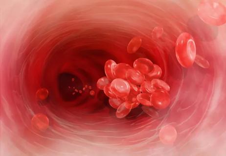 Blood Clot Cell Artery