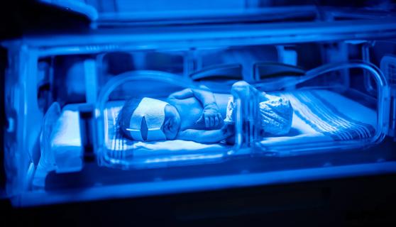 Newborn baby being treated with blue UV light for jaundice