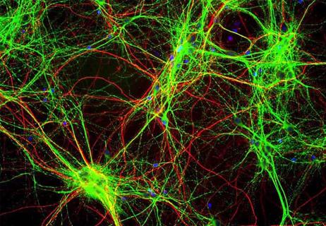 20-NEU-1946228 neurofilaments_650x450