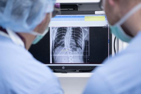 Cleveland Clinic providers looking at an x-ray of a patients spine.