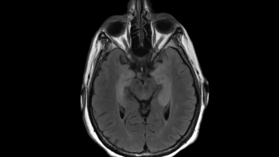 scan of a human brain