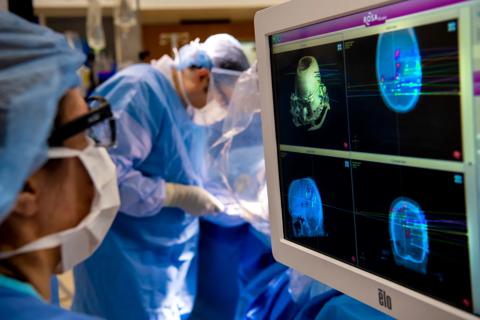 epilepsy surgery