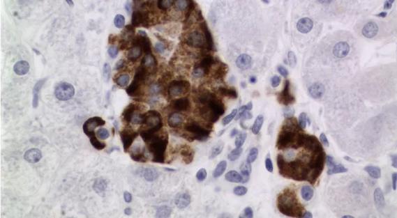 pancreas-islet-image_690x380