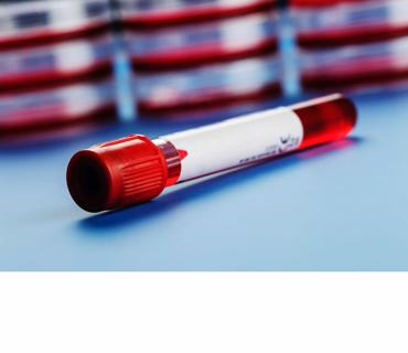 Blood sample in a tube on a blue table