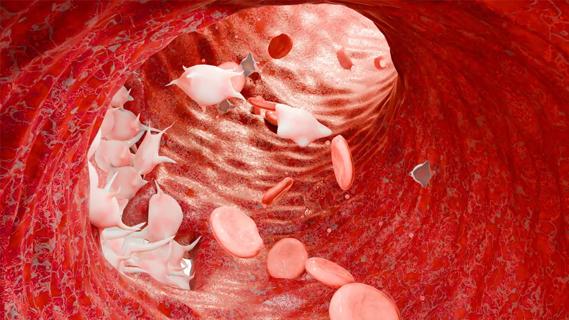 Medical illustration of blood cells