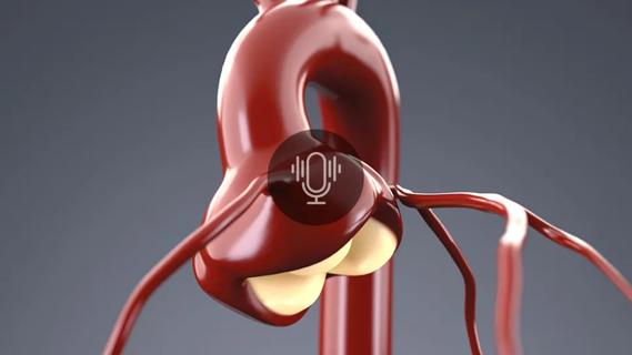stylized rendering of a bulging aortic root with podcast icon overlay