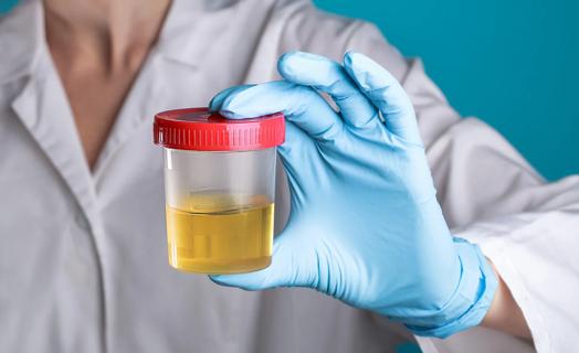 Healthcare provider holding urine sample with gloved hands