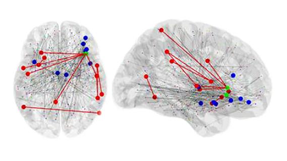 two brain images with colored dots and red line overlays