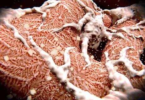 Photo: Podocytes wrapped around a glomeruli in the kidney
