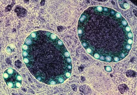 650&#215;450-COVID-Nasal-Cells