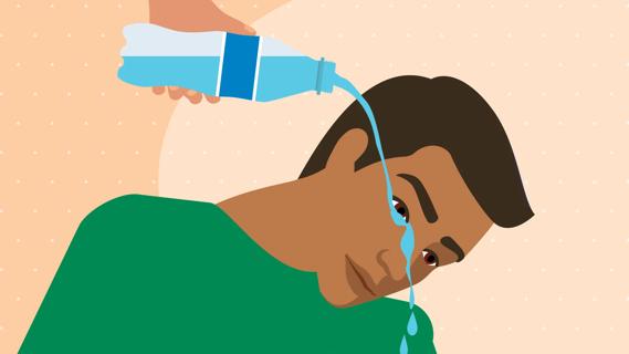 Person pouring bottled water over eye to flush it out