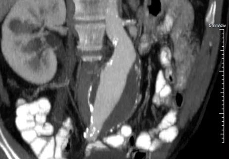 imaging scan of abdominal organs
