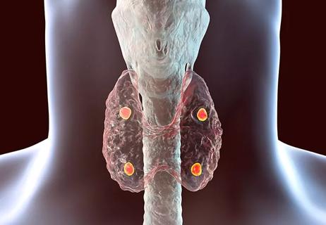 parathyroids