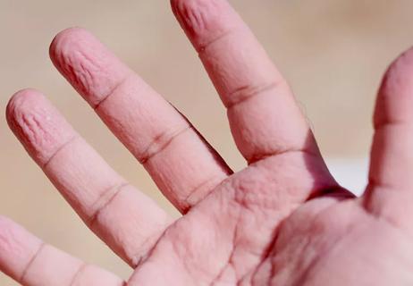 Closeup of wrinkles on fingers and hand due to water exposure for an extended period.