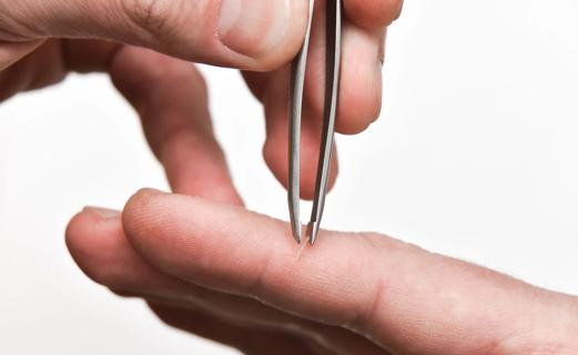 Hand holding tweezer, removing splinter from finger