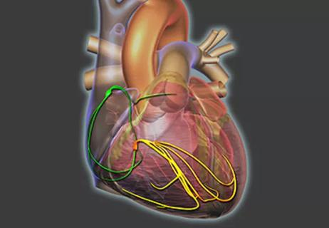 20-HVI-1898976-heart-electrical-conduction-650&#215;450
