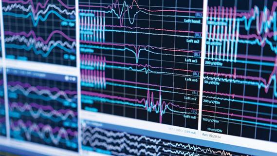 screen showing EEG tracings from multiple patients