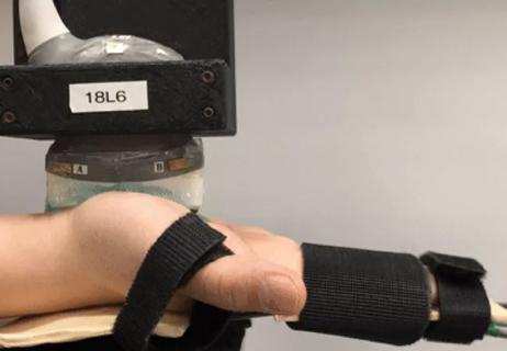19-ORT-1132-Nerve-Mobility-CQD-Hero