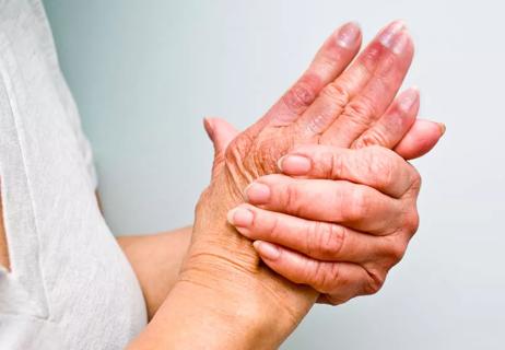 Clasped woman's hands suffering from chilblains