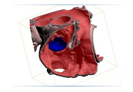 3-D Cardiac Imaging