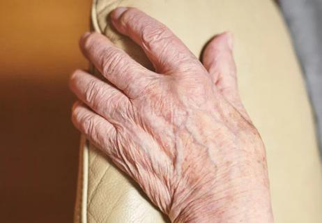 aged hands with crepey skin