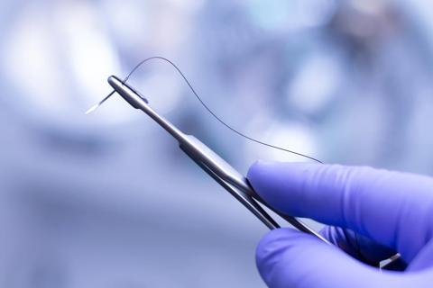 Sutures thinner than a human hair are used to connect ultra-small microvessels and lymphatics during supermicrosurgery