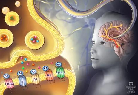AAs_ChronicPain_135629_650x450_wLabels