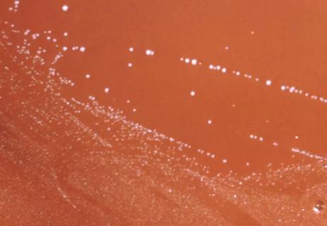 sepsis_650x450