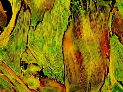 Lung fibroblasts isolated from a preclinical model were stimulated with TGF-β to induce myofibroblast differentiation