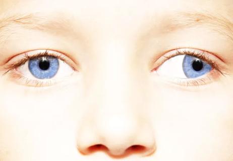 23-EYE-4284060-CQD-Myopia-progression-children