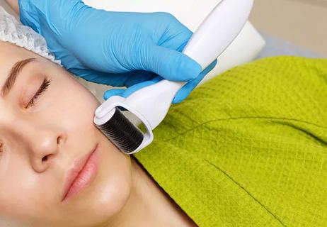 woman undergoing microneedling procedure for wrinkle reduction