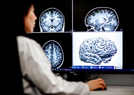 Dr. Irene Wang, a staff scientist at the Cleveland Clinic Epilepsy Center, studying brain scans.