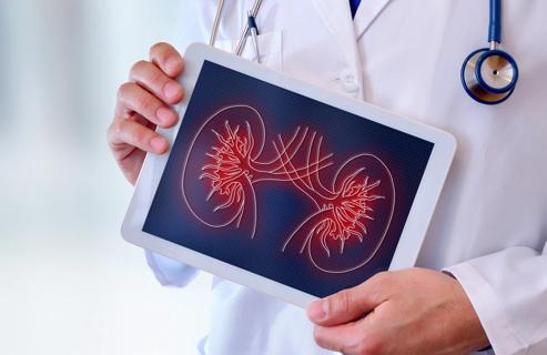 Physician holding tablet with kidney image on it