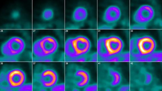 series of cardiac pet scans