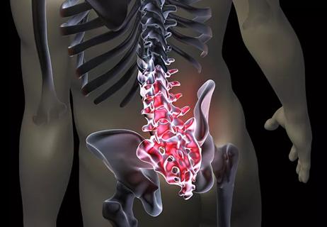 Prioritizing Function Over Pills and Procedures for Chronic Low Back Pain