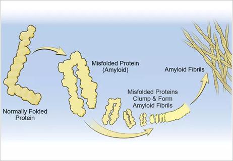 Amyloid-fib_650x450