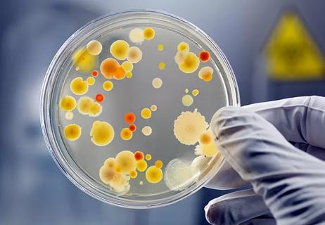 Microbes growing in petri dish