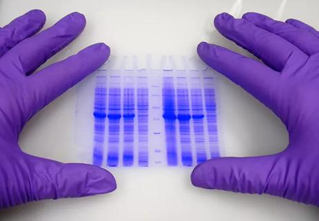 Hands in protective gloves hold blue-stained electrophoresis gel.