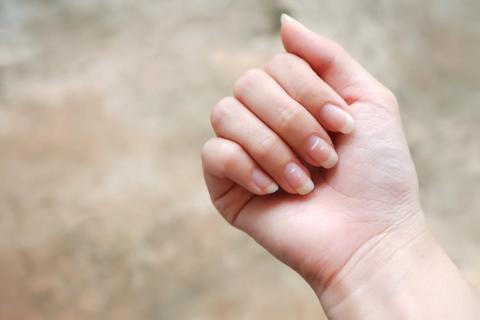 Hand folded down to see fingernails, with horizontal white lines on nails